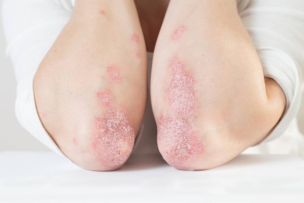 Dermatologie près de Tarbes 